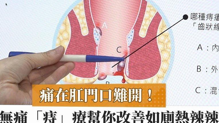 得物分期能提高我的信用额度吗？深度揭秘！